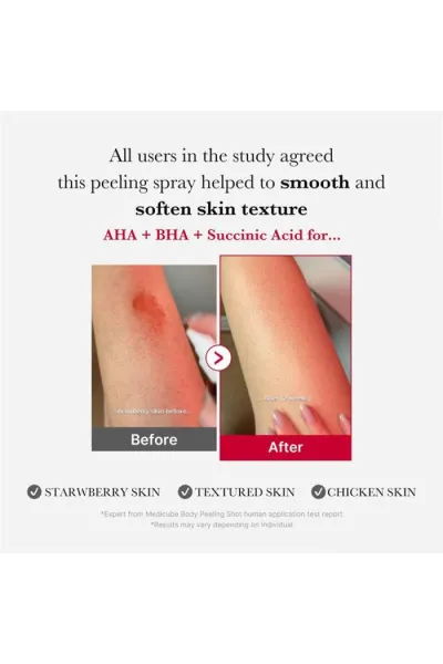 قابلیت لایه برداری خودکار برای بیرون کشیدن مشکلات از درون مانند یک خون آشام طراحی شده است. فرمول اسپری که با ۳۲٪ AHA+BHA+PHA+LHA غنی شده است درمان سبوم  چربی  پوست مرده و منبع مشکل‌ساز. تسکین‌دهنده‌ی پوست مستعد آکنه (وزارت ایمنی غذا و داروی کره جنوبی) آزم مدی کیوب Medicube اسپری لایه بردار و ضدجوش بدن Red Body Peeling Shot