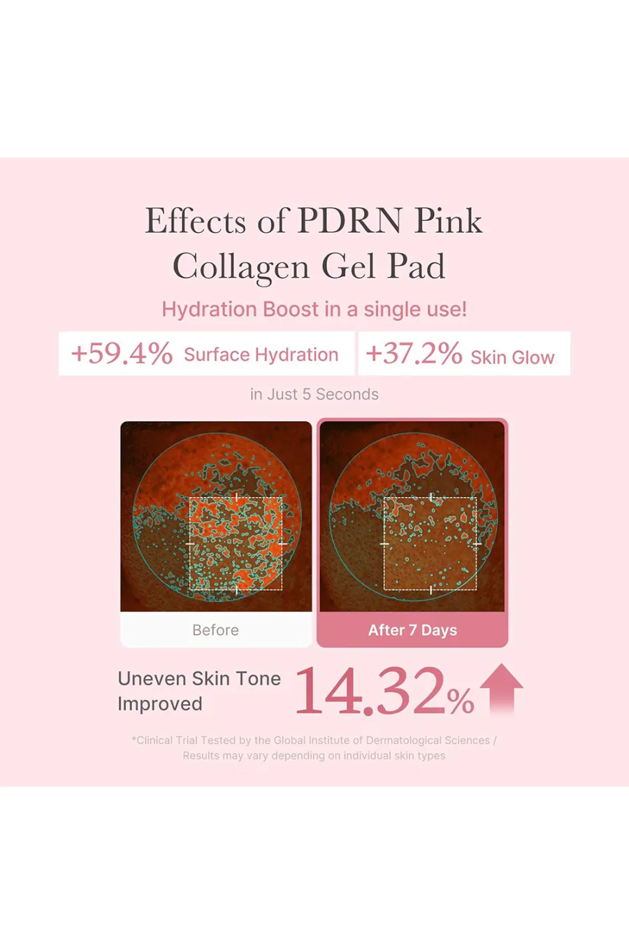 PDRN (DNA ماهی سالمون): جوان‌ساز  ترمیم‌کننده  ضدالتهاب  کلاژن صورتی: آبرسان  ضدچروک  سفت‌کننده پوست  آدنوزین و نیاسینامید: روشن‌کننده  ضد لک  تنظیم رنگ پوست  بتائین و آلوئه‌ورا: مرطوب‌کننده و تسکین‌دهنده مدی کیوب Medicube پد تونر ژلی PDRN و کلاژن PDRN Pink Collagen Toning Gel Toner