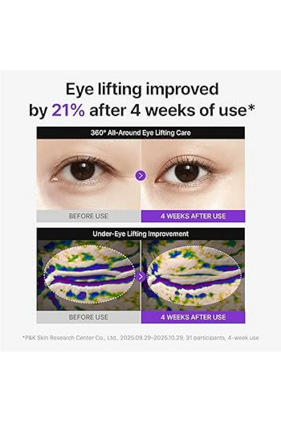 ترکیب قدرتمند PDRN + TECA + Retinol لیفتینگ ۳۶۰ درجه دور چشم کاهش تیرگی  پف و چین‌وچروک ترمیم و تقویت پوست حساس بافت سبک و سریع‌الجذب حجم ۳۰ میلی‌لیتر اقتصادی مناسب استفاده روزانه و شبانه سنتلیان Centellian24 کرم دور چشم شات لیفتینگ و ضدچروک PDRN